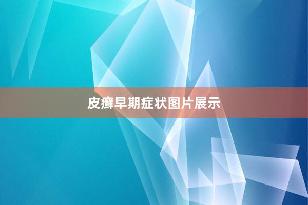 皮癣早期症状图片展示